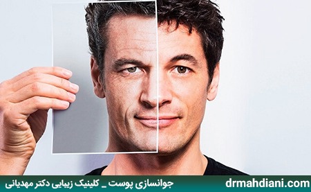 جوانسازی