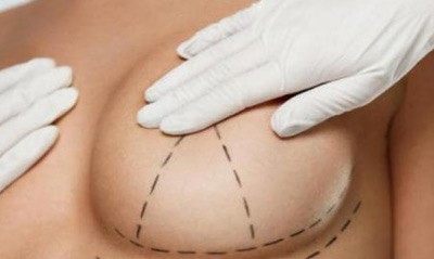 فناوری لیزر در لیفت سینه