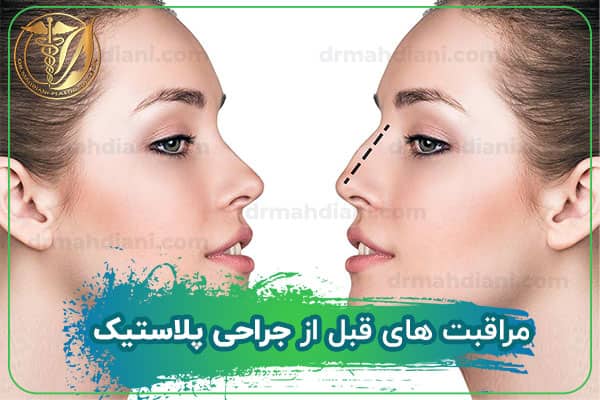 مراقبت های قبل از جراحی پلاستیک
