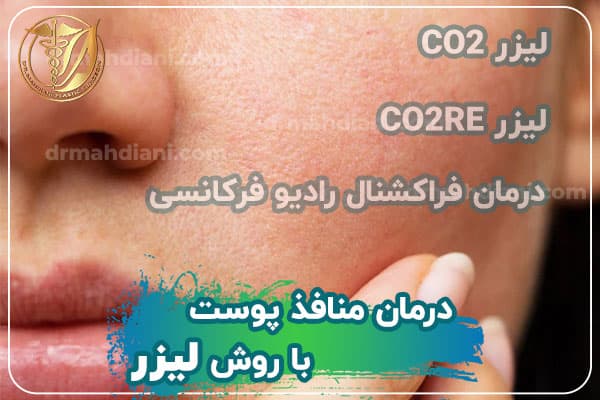 درمان منافذ پوست با لیزر