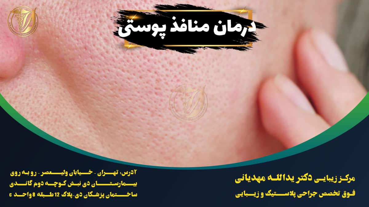 درمان منافذ پوستی
