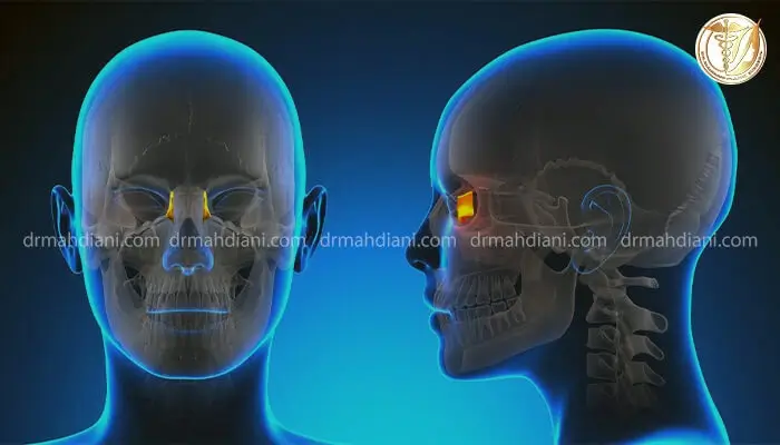 نواحی درگیر عوارض بلندمدت درمان نکردن شکستگی صورت